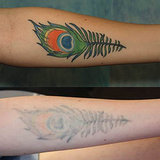 How to Get Rid of a Tattoo How to Get Rid of a Tattoo