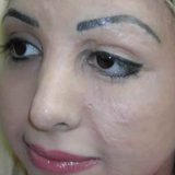 Watch a Tattoo Artist Change a Burn Victim's Life With Permanent Makeup Watch a Tattoo Artist Change a Burn Victim's Life With Permanent Makeup