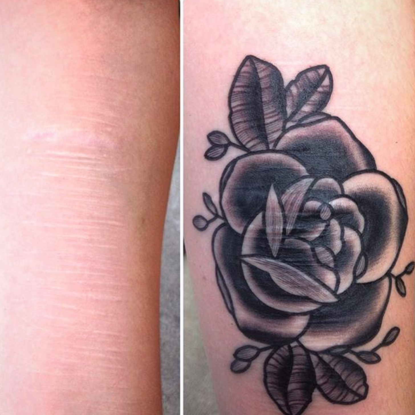 Tattoo Artist Helps People Cover Scars With Tattoos (Video) POPSUGAR