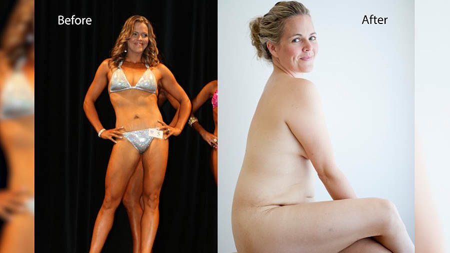 This Woman's Bold Before-and-After Photo Isn't What You'd Expect