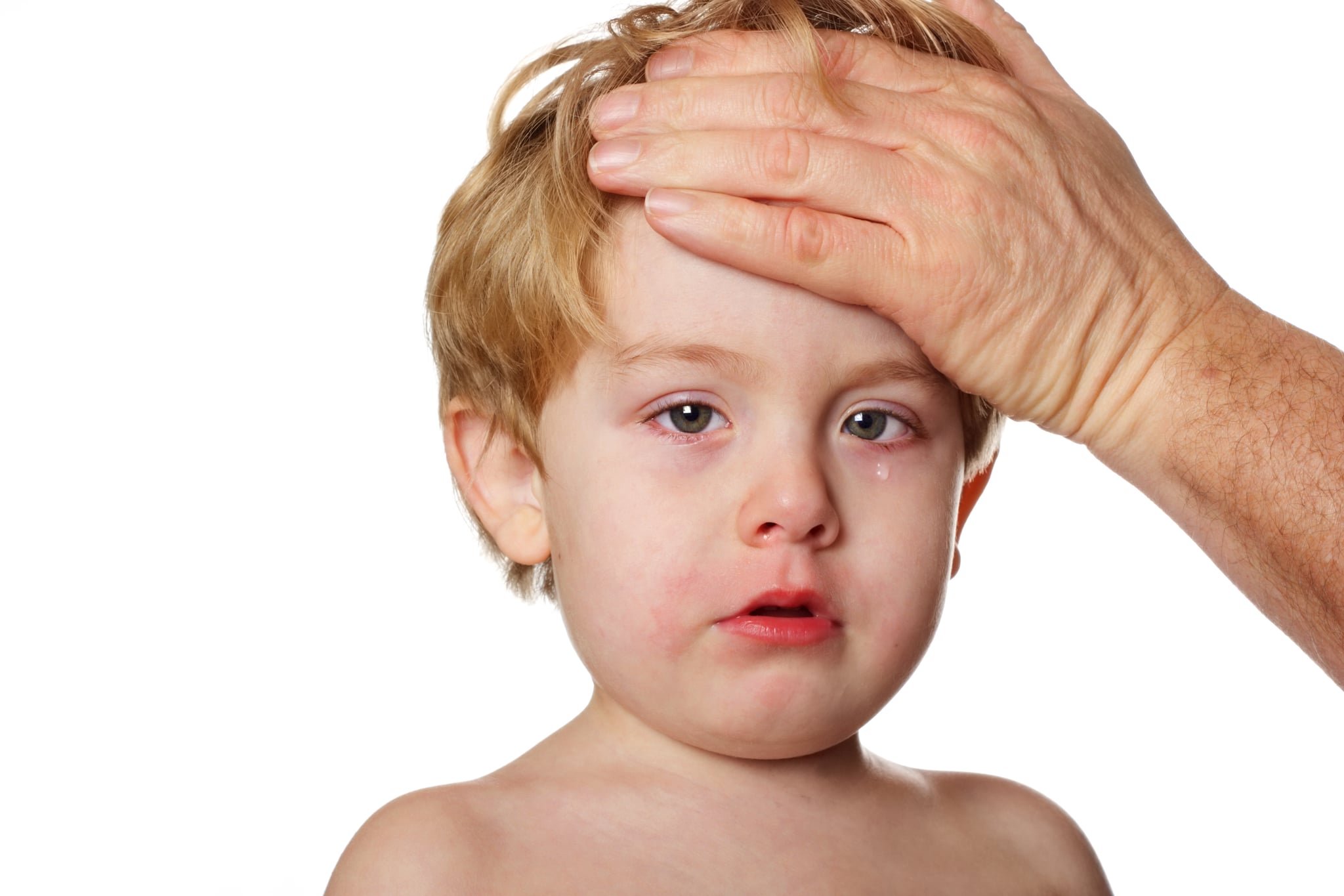 Dealing With Hand, Foot, and Mouth Disease in Toddlers POPSUGAR Moms